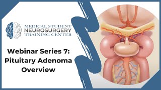 Pituitary Adenoma  Overview [upl. by Asilehc]