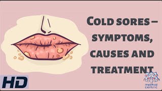 Cold Sores – Symptoms Causes and Treatment [upl. by Einnaoj292]