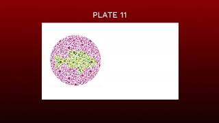 TEST YOURSELF  COLOR BLIND CHILD TEST [upl. by Cormier]