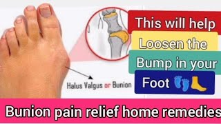 Bunion pain relief home remedies [upl. by Clintock43]