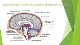 Subarachnoid Cisterns – Anatomy [upl. by Groeg]