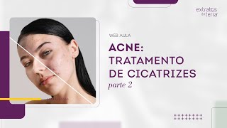 Cicatriz de Acne Plano de Tratamento Completo  Web Aula Gratuita 172 [upl. by Hutchins]