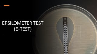 ETest Epsilometer Test [upl. by Valentin733]