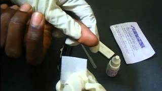 HIV Antibody Test Using A Rapid HIV Card [upl. by Julienne]