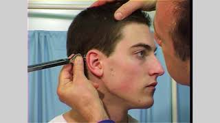 Vestibulocochlear nerve examination  Eighth cranial nerve [upl. by Arua]