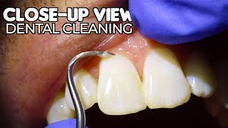 Dental Cleaning  CloseUp View ASMR [upl. by Eiaj652]