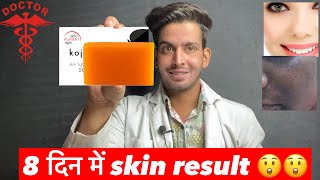 Kojie san soap  Kojie san soap review  kojie san  kojic acid soap  kojic acid soap review kojie [upl. by Arabrab]