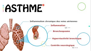 Asthme état stable 😷  Résumé  PneumoPhtisiologie [upl. by Alesiram]