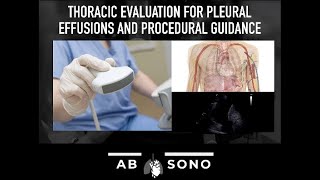 Thoracic evaluation for pleural effusions and procedural guidance [upl. by Adhern]