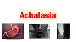 Achalasia CardiaGastroenterologyMedicineDrTayyibaarshad [upl. by Alram144]