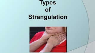 Asphyxial deaths lecture2Strangulation [upl. by Niwrek]