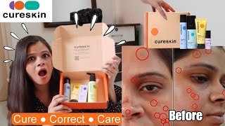 Cureskin App amp Products Review amp Everything In Between  Honest Cureskin Review  Kamna Sharma [upl. by Niledam]