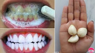 White teeth at home in 3 minutes  How To Have Natural White Teeth in 3 minutes  Works 100 [upl. by Finer31]