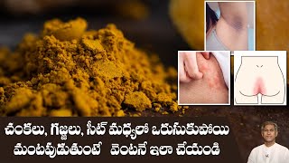 Best Remedy to Reduce Fungal Infections  Skin Rashes and Itching  Dr Manthenas Health Tips [upl. by Dream]