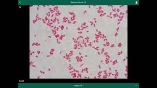 escherichia coli  الإشريكية القولونية [upl. by Ennairej]