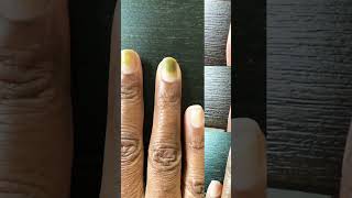 Greenies in my clients nails subscribe beginnerfriendly educational [upl. by Engenia]