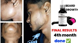 beard growth  man matters minoxidil review  derma roller for beard growth  man matters beard oil [upl. by Mojgan]