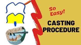 PROSTHODONTICS  Casting procedure in dentistry [upl. by Allana]