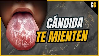 ¿Obesidad y Depresión por culpa de un HONGO  Sobrecrecimiento de CANDIDA [upl. by Olmstead]