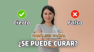 Mitos y Realidades de la Parálisis facial de Bell [upl. by Alphonsa903]