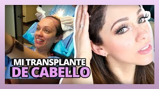 MI TRANSPLANTE DE CABELLO  HAIR TRANSPLANT SURGERY  RosyStoryTime [upl. by Loomis729]