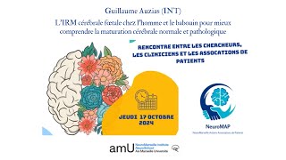 NeuroMAP  Guillaume Auzias Chargé de Recherche INT [upl. by Antsirhc393]