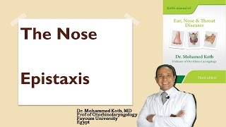 The nose Epistaxis causes amp management Professor Dr Mohamed Qotb [upl. by Jacquelynn483]