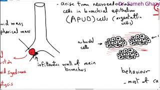 Systemic pathology 39  respiratory system 5  tumors of lung  DRSAMEH GHAZY [upl. by Ashlie]