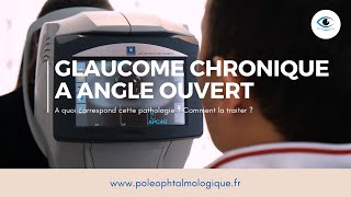 Glaucome chronique à angle ouvert Pole Ophtalmologique [upl. by Refinneg]