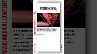 Prostatectomy prostatectomy prostatecancertreatment prostatecancerawareness [upl. by Quintin]