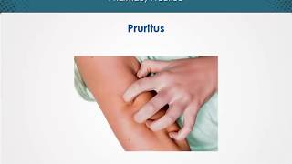 Pruritus  Dermatology  EduRx [upl. by Ahselyt936]