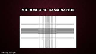 Microscopic examination of CSF  Cerebrospinal Fluid  Microscopy [upl. by Carling460]