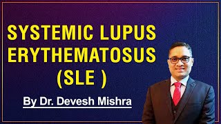 Systemic Lupus Erythematosus SLE by Dr Devesh Mishra [upl. by Patnode]