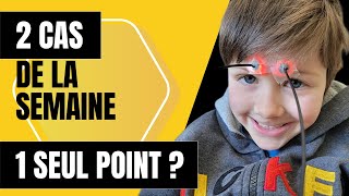 Astuces simples DACUPUNCTURE SANS DOULEUR pour traiter la sinusite des enfants ou la gorge irritée [upl. by Dralliw]