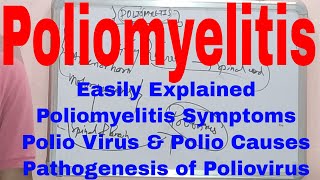 PoliomyelitisWhat is PoliomyelitisPoliomyelitis SymptomsPolio CausesPathogenesis of Poliovirus [upl. by Animar706]