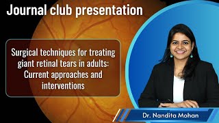 Journal ClubSurgical techniques for treating giant retinal tears Current approaches interventions [upl. by Lahcim]