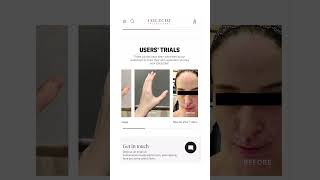 Stem Cell Skincare Results You WONT Believe [upl. by Gudrun]