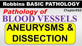 Ch12  Aneurysms amp Dissection  Blood Vessel Pathology  Robbins Lectures [upl. by Euhsoj347]