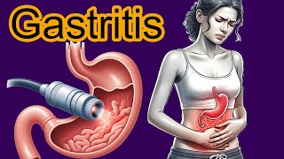 5 Early signs of Gastritis Gastritis diagnosis and treatment [upl. by Orfinger957]