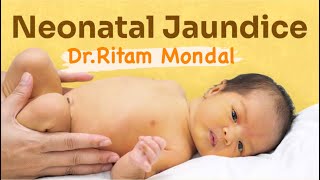 Newborn Jaundice  what to do by DrRitam Mondal MD [upl. by Ateloiv]