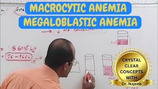 Macrocytic Anemia  Megaloblastic Anemia 🩺 [upl. by Eldrida]