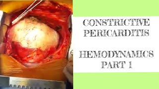 Constrictive pericarditis hemodynamics  1 [upl. by Mloc]