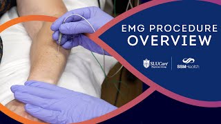 The EMG Procedure Overview of the Nerve Conduction Study Process [upl. by Rehpotsihc]