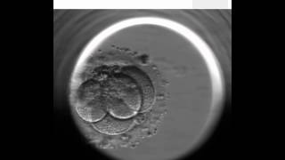 EmbryoScope  artificial fertilization technique [upl. by Attolrac]