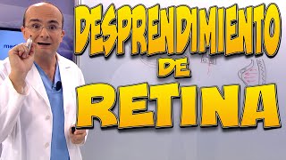 DESPRENDIMIENTO DE RETINA QUÉ es CÓMO se produce QUÉ SÍNTOMAS notamos y CÓMO es el TRATAMIENTO [upl. by Brightman]