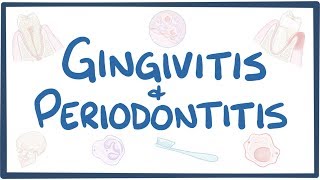 Gingivitis and periodontitis  causes symptoms diagnosis treatment pathology [upl. by Thetes452]