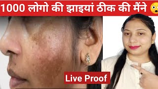 दीदी आप खुश रहो आपके बताए हुए नुस्खे से मेरी pigmentation 90 चली गई एक हफ्ते में🤗Part2 [upl. by Feodora]