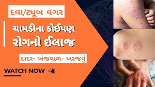 dhadhar skin problem solution In gujarati  gujarati ajab gajab [upl. by Becka58]