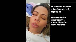 BLANQUEAMIENTO OJERAS CON CARBOXITERAPIA CO² [upl. by Eusadnilem466]