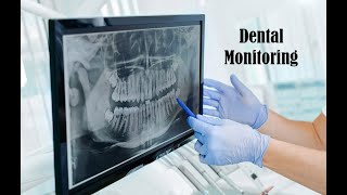 Dental Monitoring [upl. by Netsyrk]